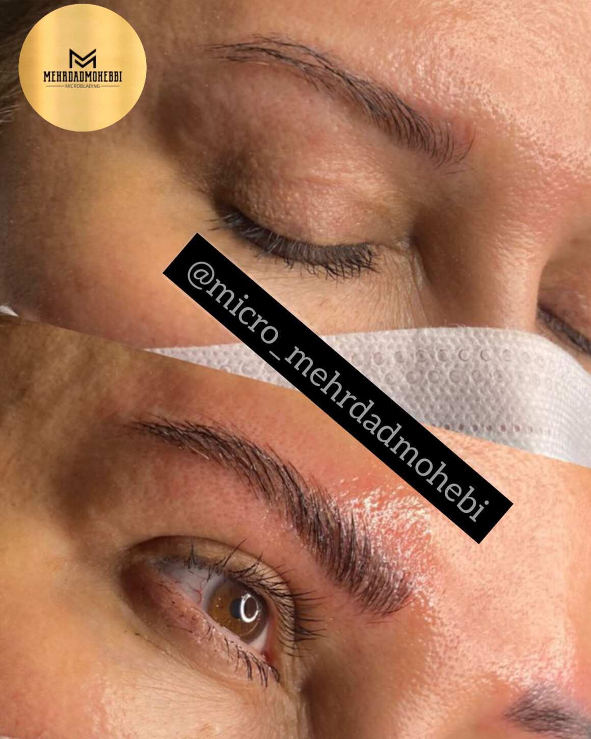 میکروبلیدینگ آقایان اصفهان