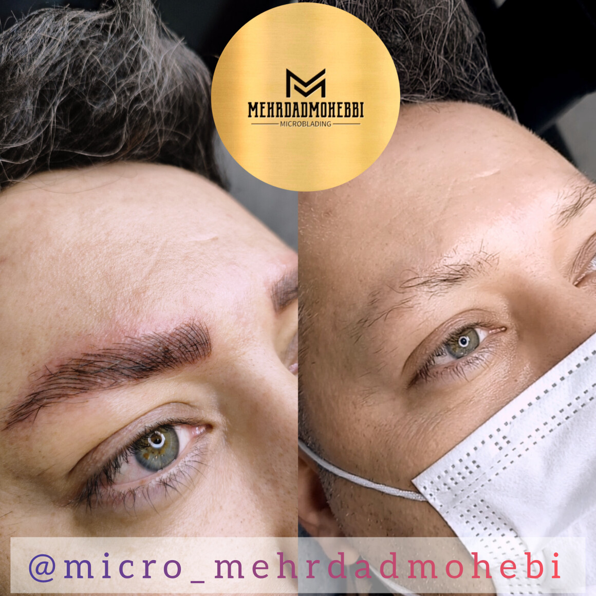 میکروبلیدینگ آقایان اصفهان