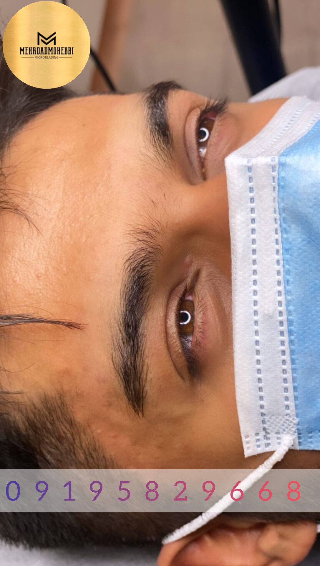 میکروبلیدینگ آقایان اصفهان نچرال