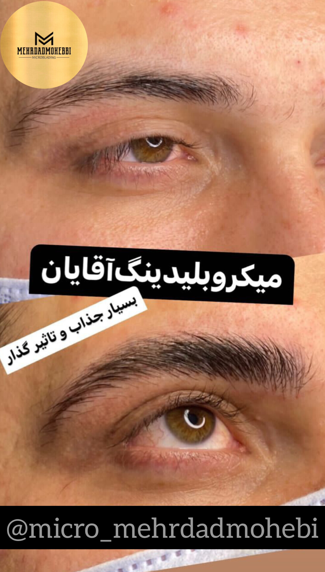 میکروبلیدینگ ابروی آقایان اصفهان