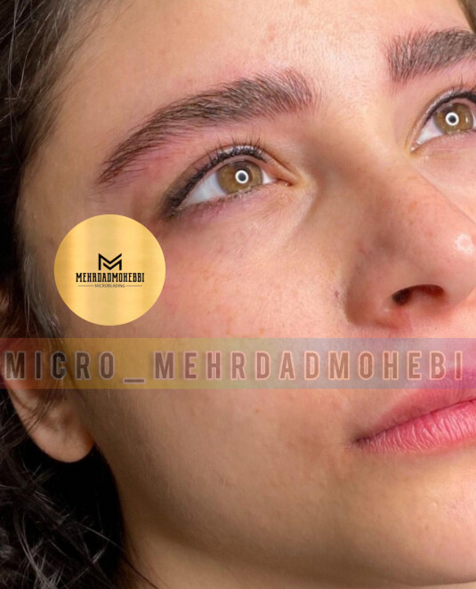 فیبروز ابرو اراک