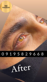  بهترین میکروبلیدینگ آقایان در اصفهان