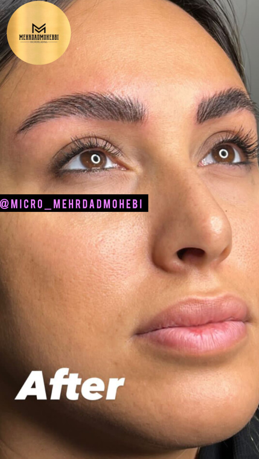 میکروبلیدینگ آقایان اصفهان