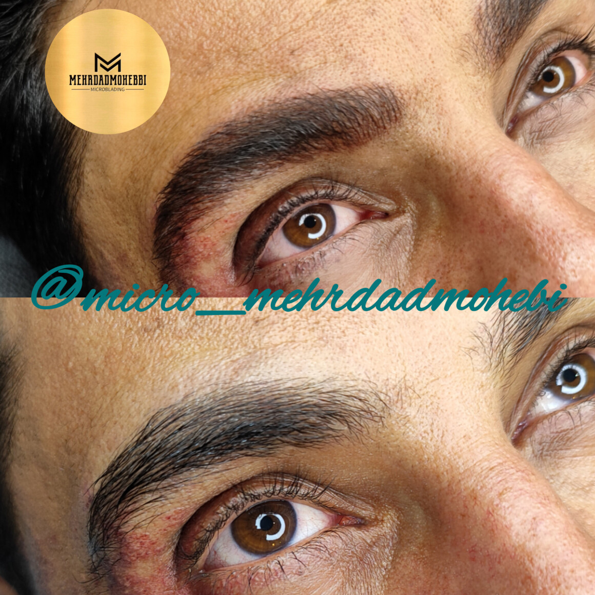 میکروبلیدینگ آقایان اصفهان