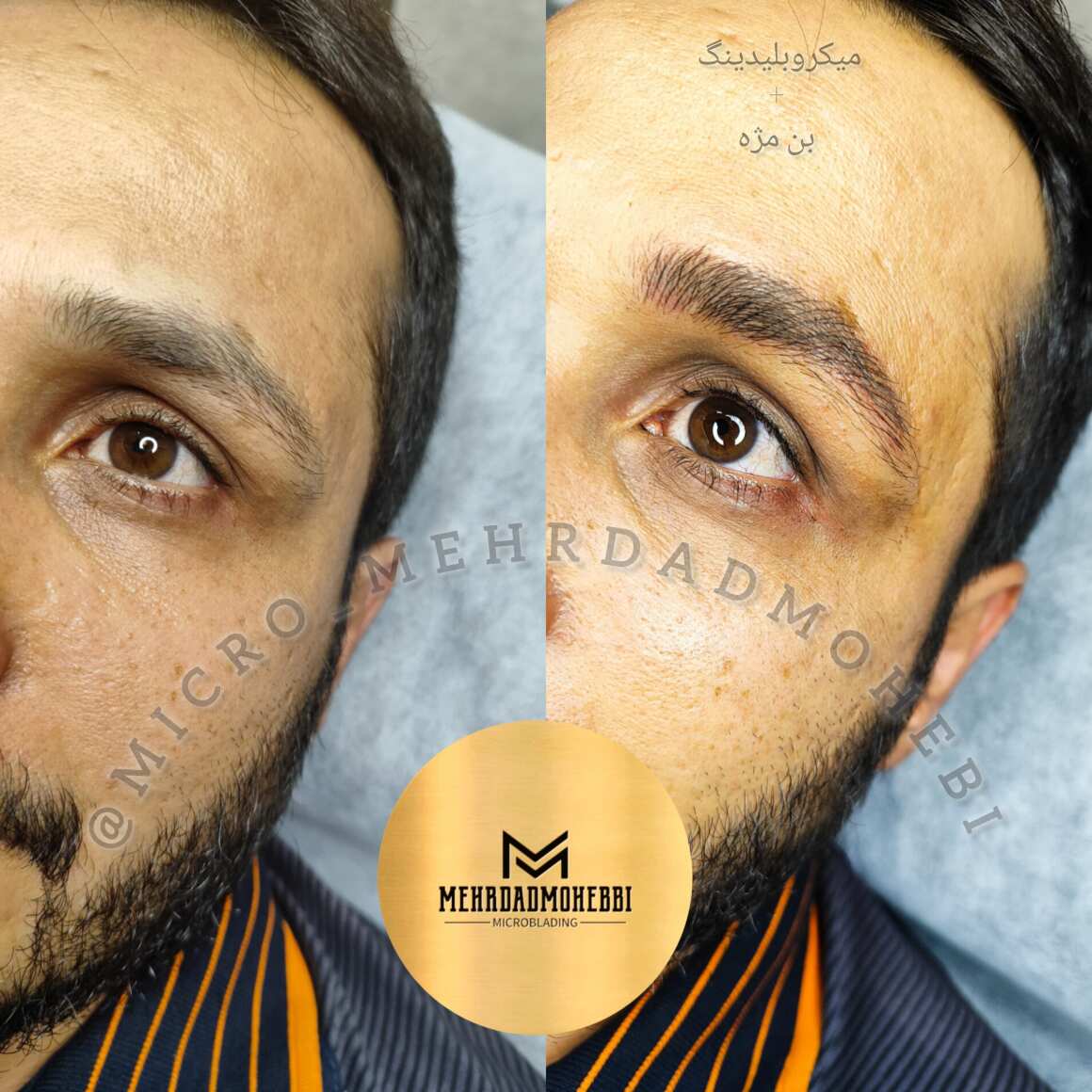 میکروبلیدینگ آقایان اصفهان