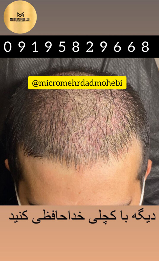 اسکالپ سر اصفهان