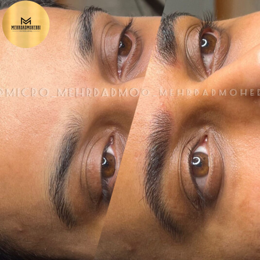 کیلینیک تخصصی میکروبلیدینگ آقایان اصفهان