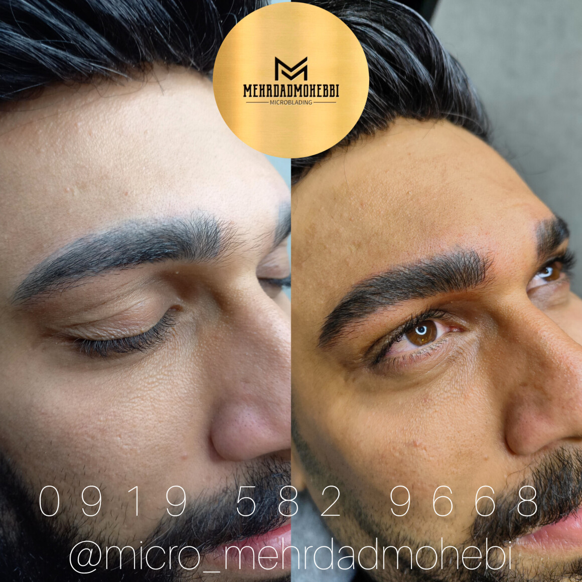 میکروبلیدینگ آقایان اصفهان