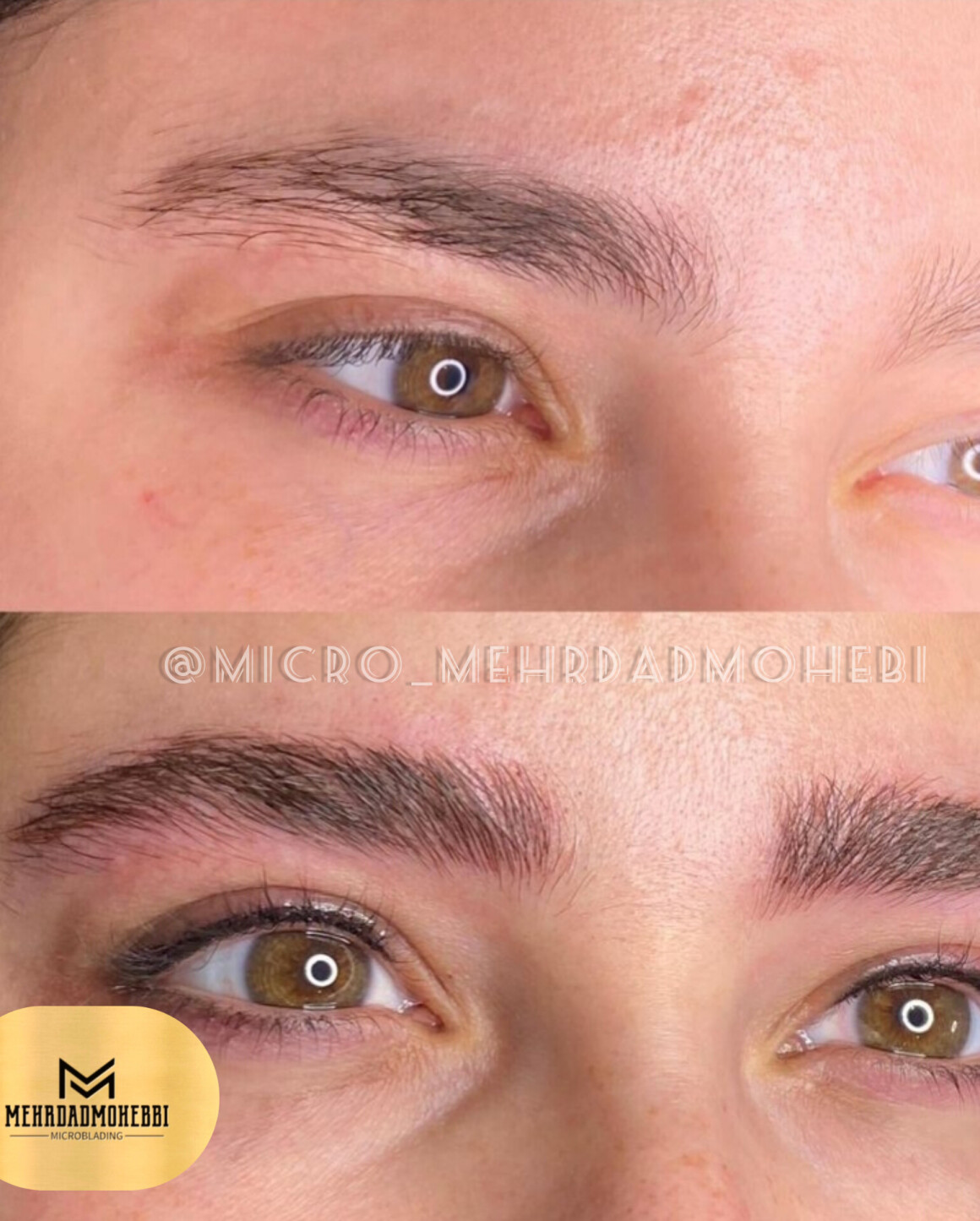 میکروبلیدینگ دخترانه اصفهان