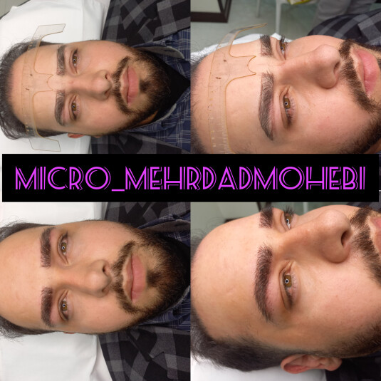 بهترین میکروبلیدینگ اصفهان و تهران