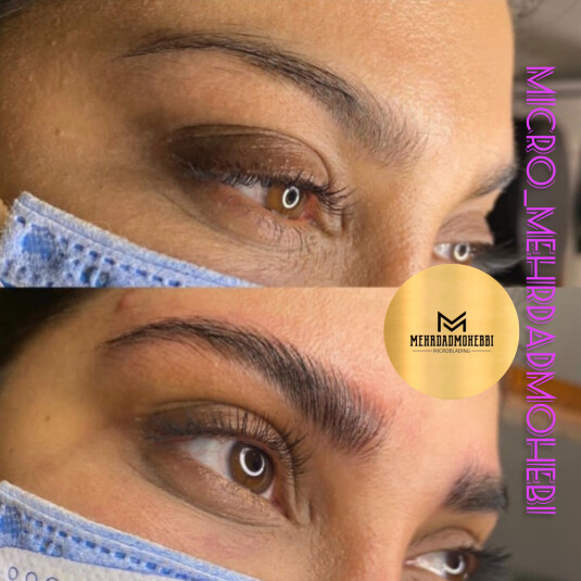 کیلیلنیک تخصصی میکروبلیدینگ اصفهان