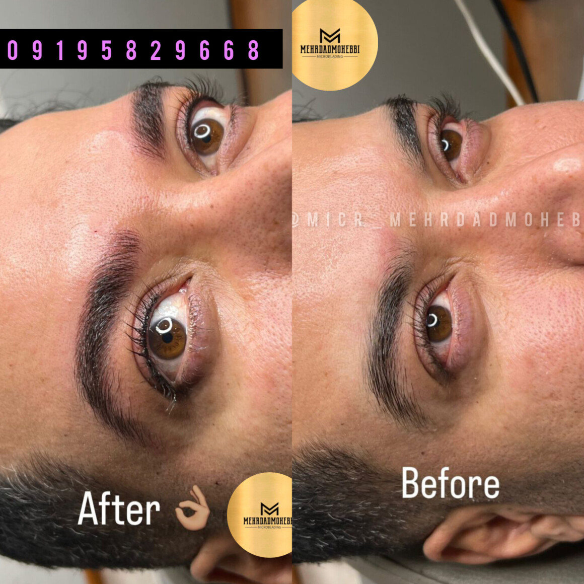 بن مژه میکروبلیدینگ آقایان